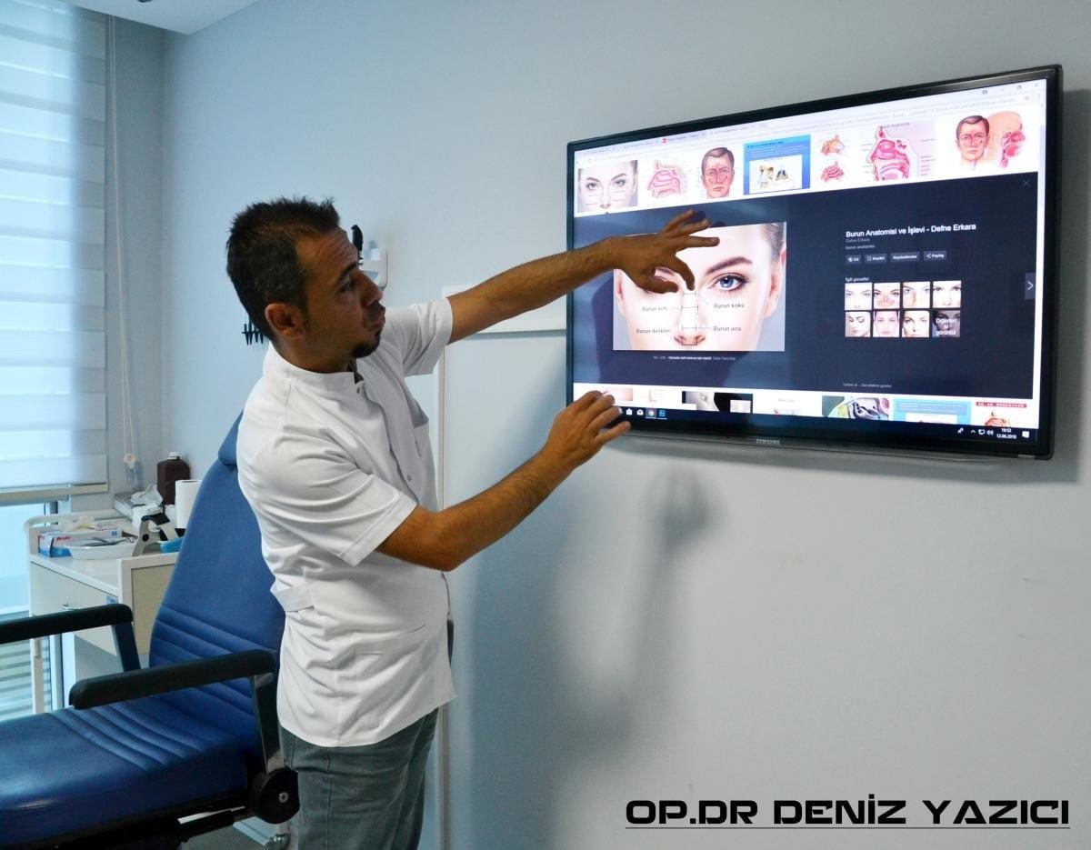 Burun Estetiği Hakkında Merak Edilenler