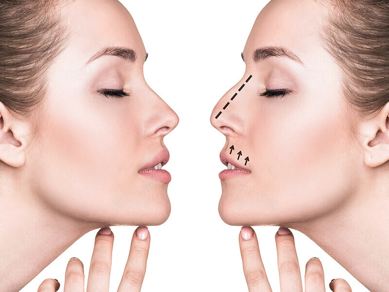 Burun Estetiği Fiyatları